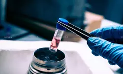 Stem Cell Banking part of “Health Care Services”, qualifies for Service Tax Exemption: Supreme Court [Read Order]